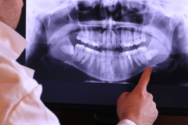 Best Mobile Emergency Dentist in Port Byron, IL