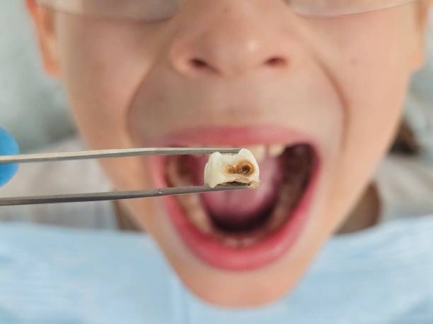 Best Urgent Dental Care for Toothache in Port Byron, IL