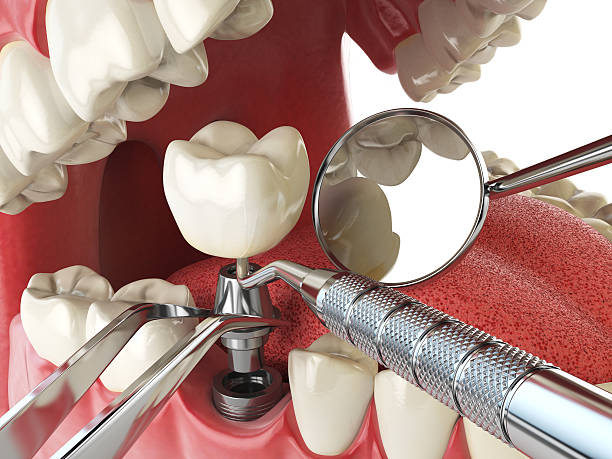 Best Pediatric Emergency Dentist in Port Byron, IL